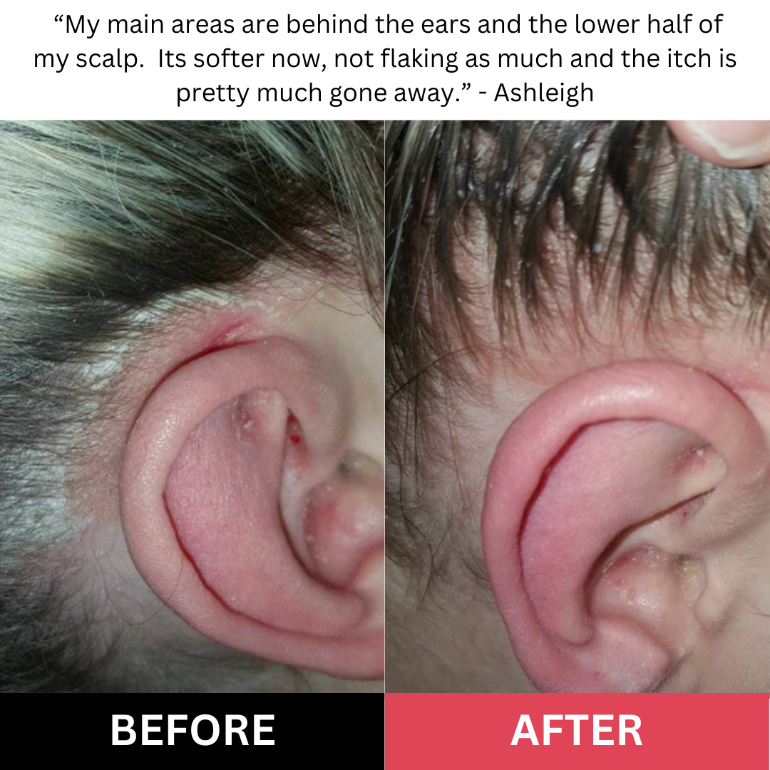 Bekynd Beauty Scalp Scrub